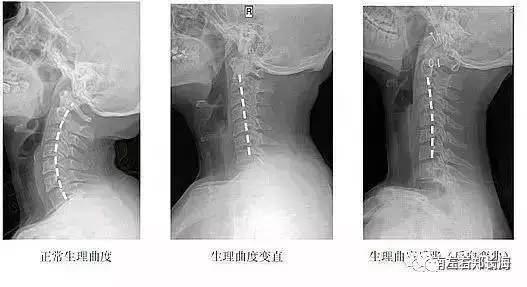 治疗颈椎病的好医院