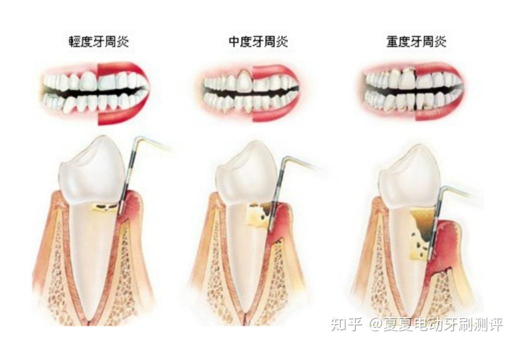 口腔备牙的详细步骤,口腔备牙的详细步骤与前沿研究解析_UHD版,时代解析说明_乡版47.91.91