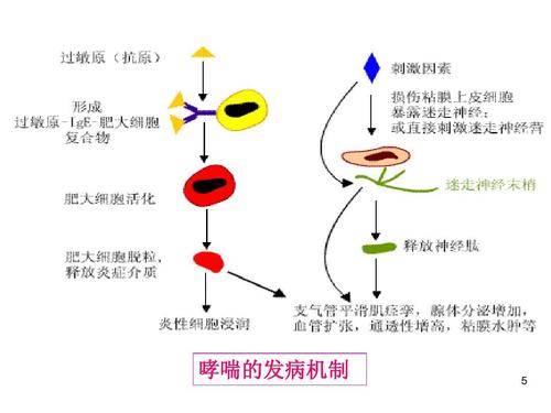 支气管哮喘怎么治疗才能除根